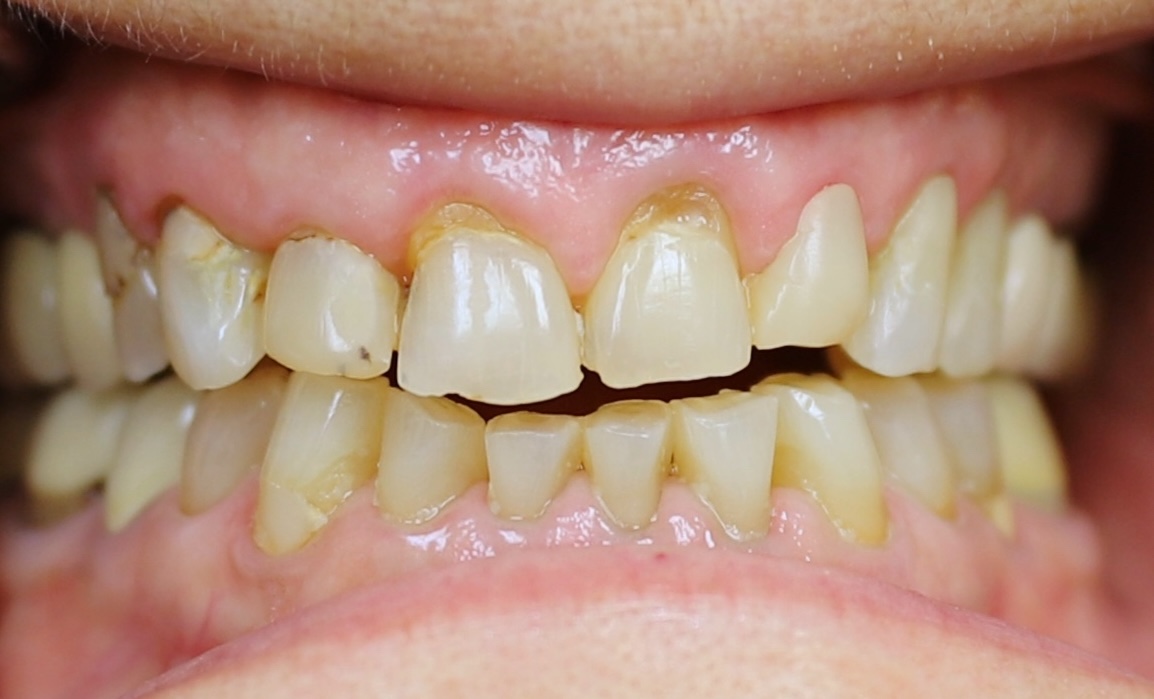 Before image