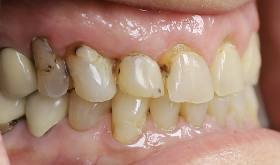 Before image