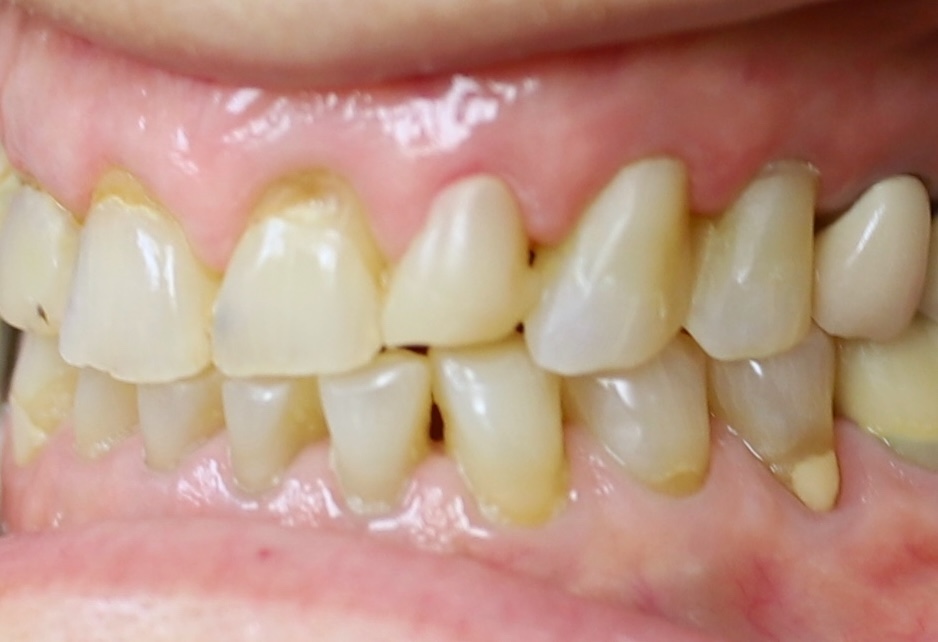 Before image