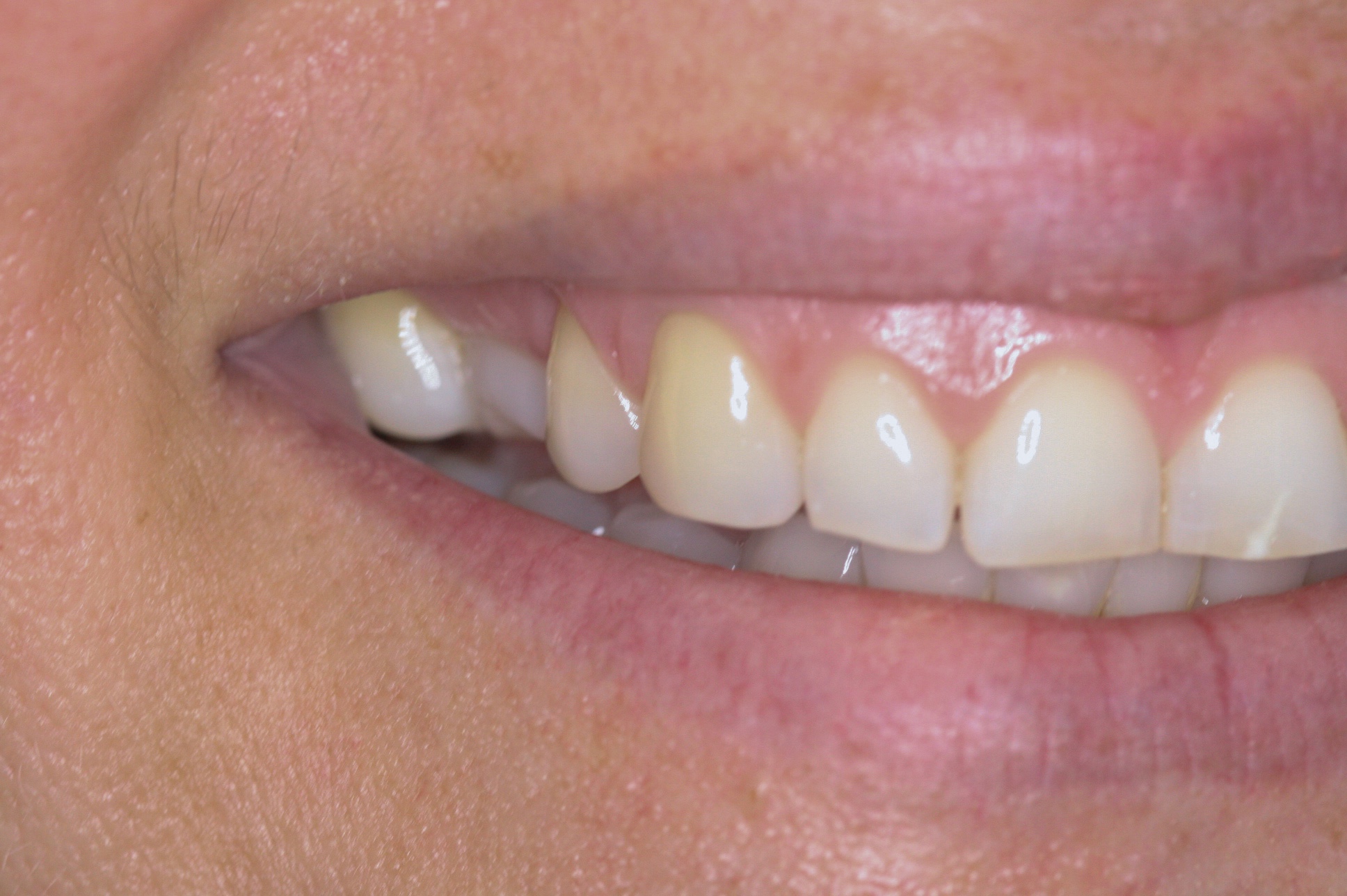 Before image