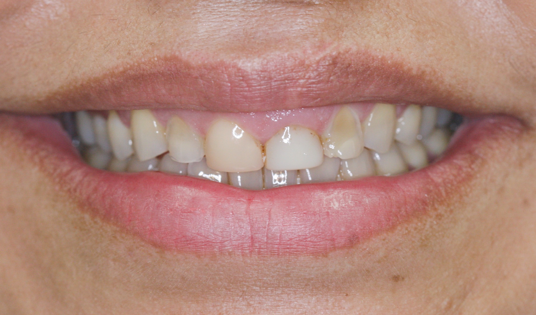 Before image